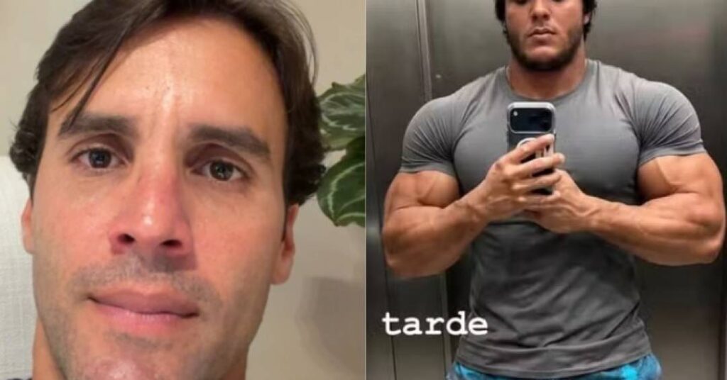 Marcelo Sangalo usou bomba? Daniel Cady responde